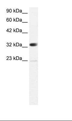 CBX4 Antibody (aa53-102)