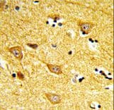Polyclonal Rabbit anti-Human INPP4B Antibody (aa367-393, IHC, WB)