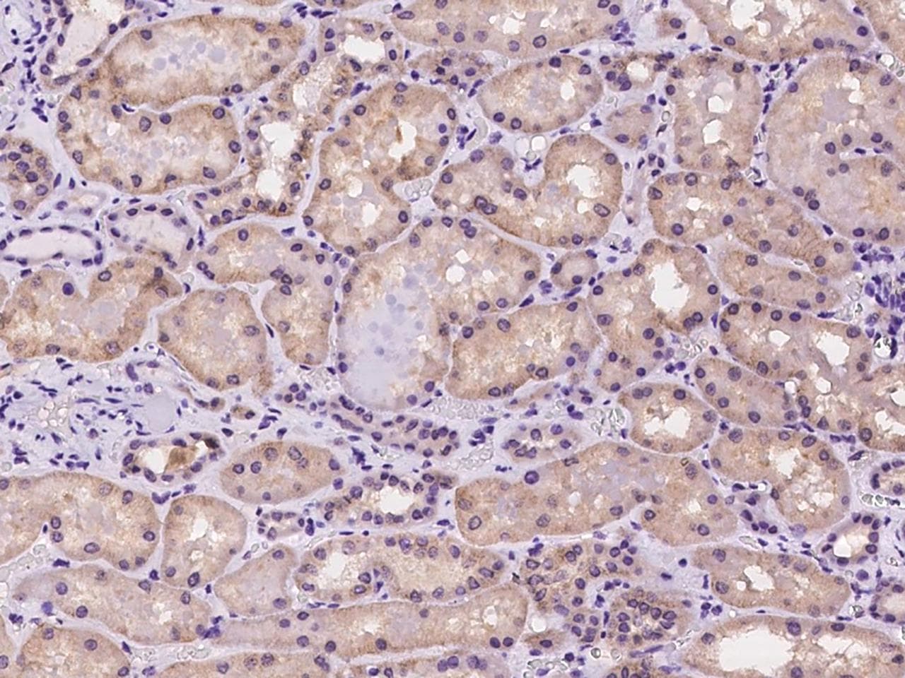 Polyclonal Rabbit anti-Human ADAMTS15 Antibody (IHC)