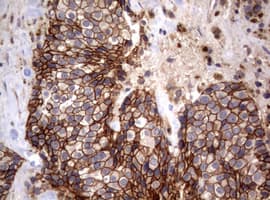Monoclonal Mouse anti-Human CTNND1 / p120 Catenin Antibody (clone OTI3G1, IHC, WB)