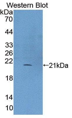 PLCB3 Antibody (aa318-468)