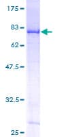 Human DDX6 Protein (Recombinant GST)