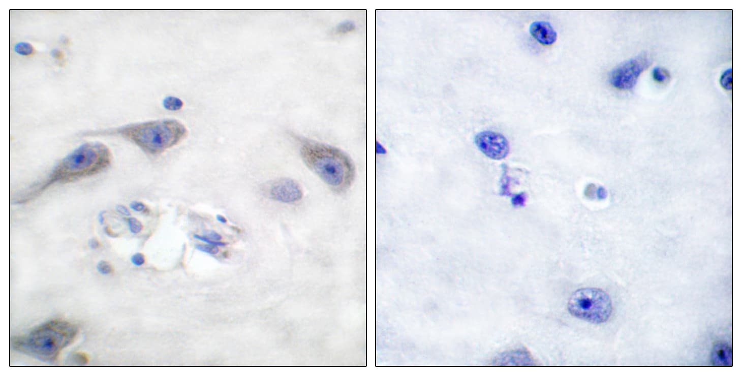 Polyclonal Rabbit anti-Human PPP1R1B / DARPP-32 Antibody (aa41-90, IHC, WB)