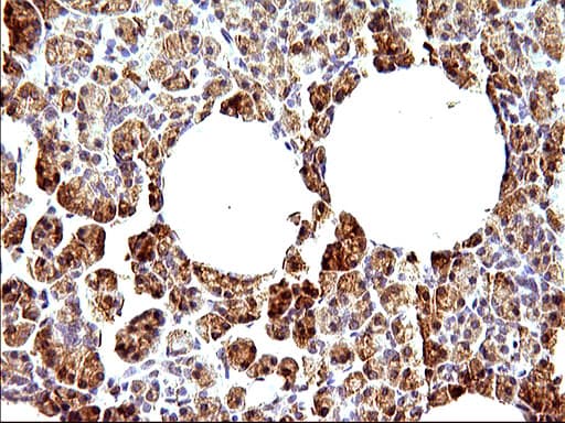 HERPUD1 / HERP Antibody (clone OTI1A2)