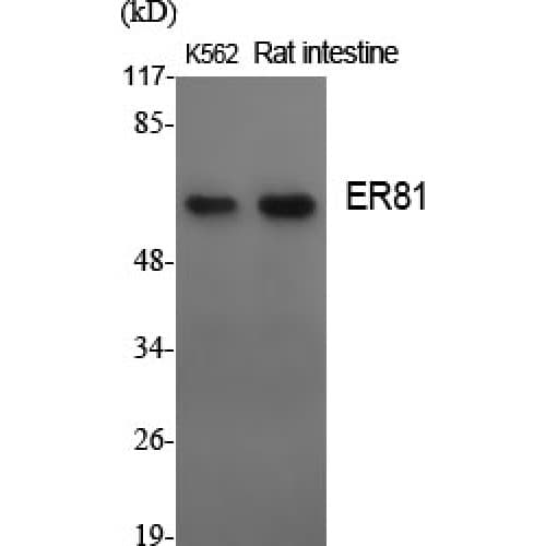 Polyclonal Rabbit anti-Human ER81 / ETV1 Antibody (10-90 aa, N-terminal, IHC, WB)