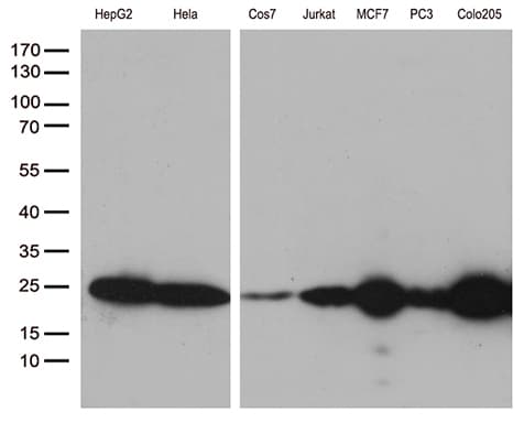MGMT Antibody (clone OTI4F9)