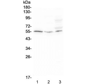 Polyclonal Rabbit anti-Human ACKR2 / CCR10 / D6 Antibody (IHC, WB)