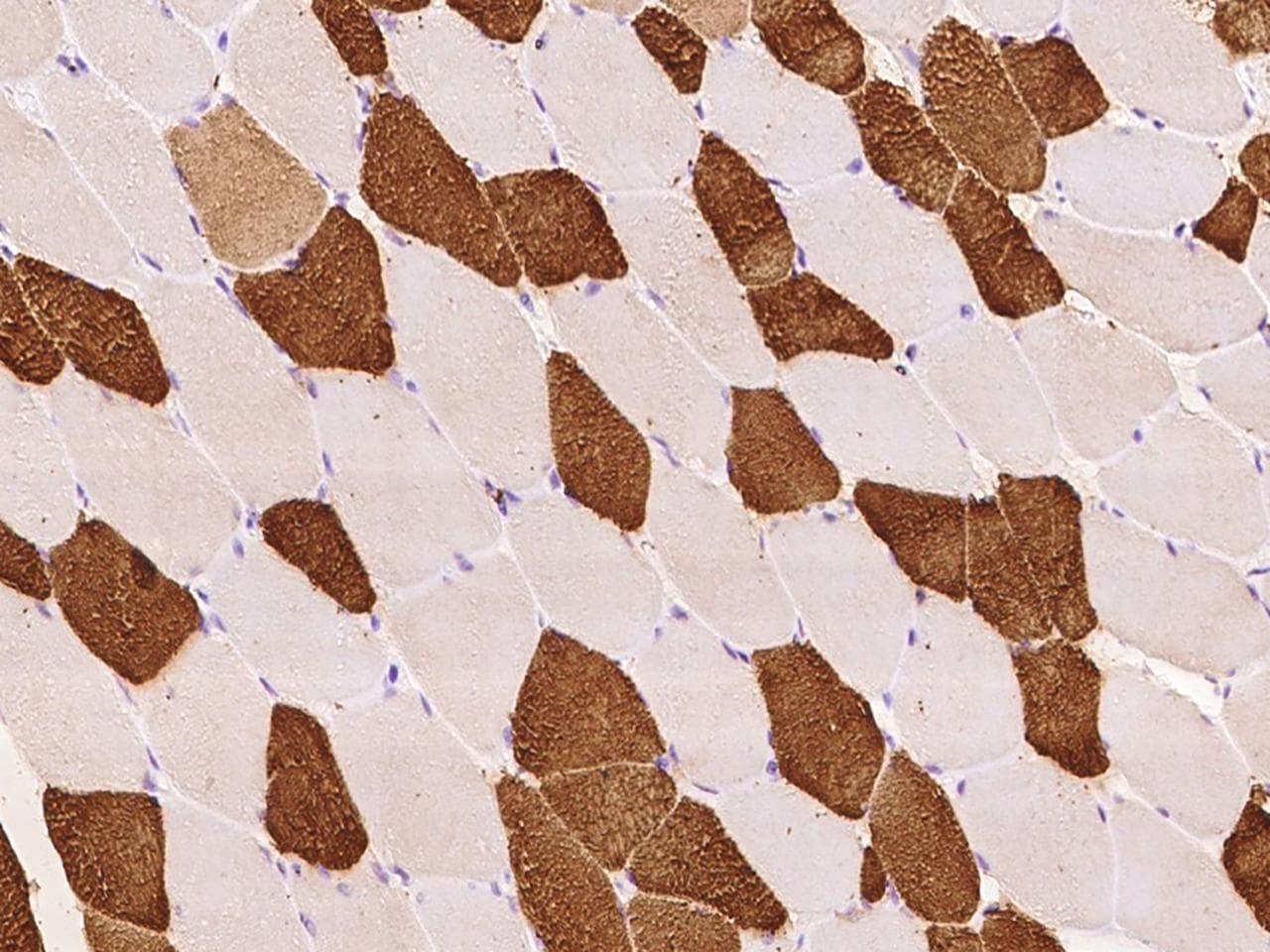 TNNT3 Antibody