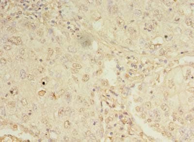 ORMDL1 Antibody