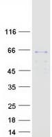 Human SGSH Protein (Recombinant Myc-DDK (Flag))