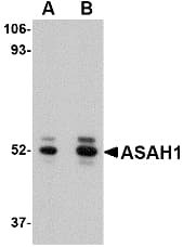 IHC-plus™ Polyclonal Rabbit anti-Human ASAH1 / Acid Ceramidase Antibody (IHC, IF, WB)