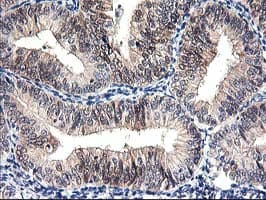 PRMT2 Antibody (clone OTI3A3)