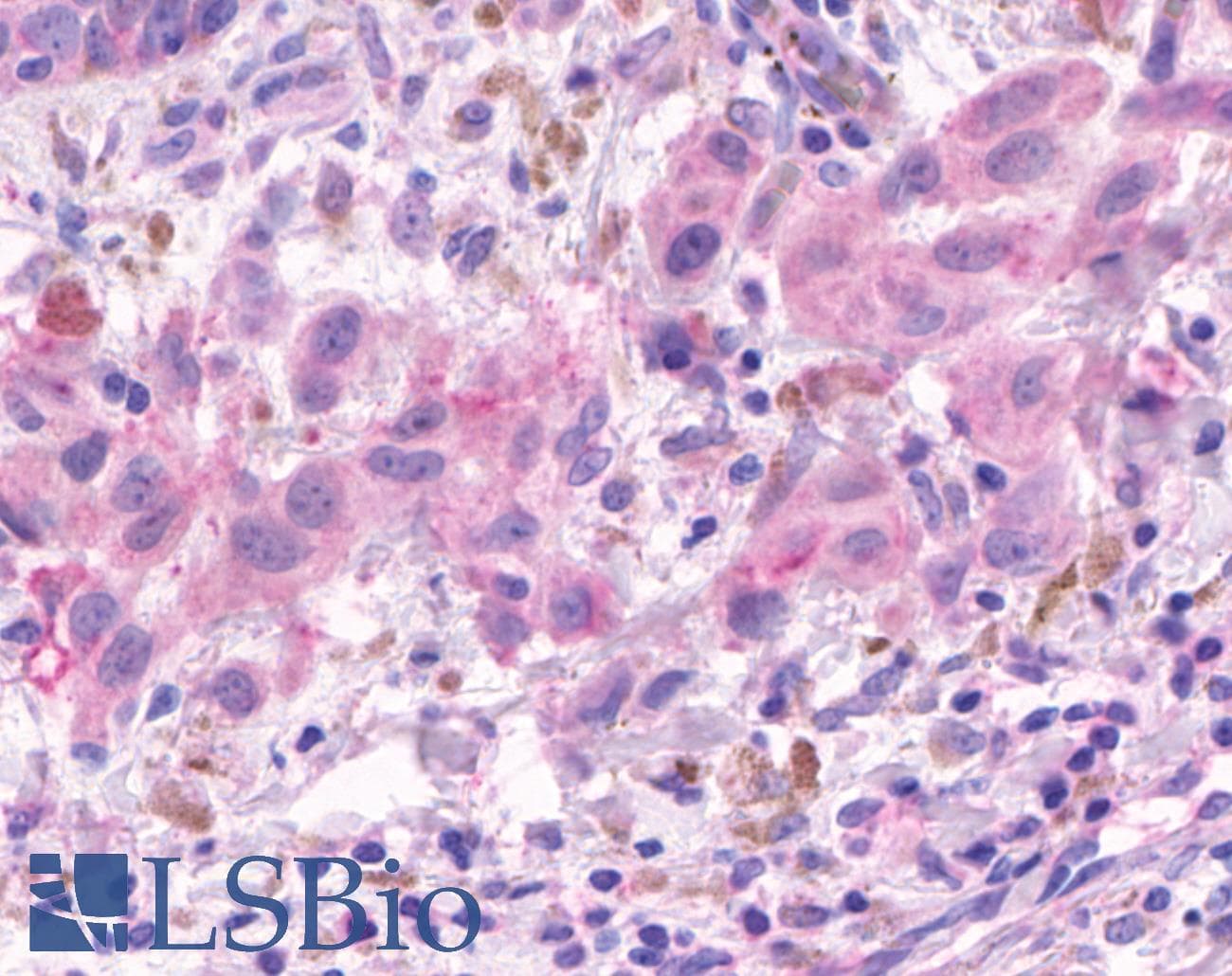 PathPlus™ OR2A4 Antibody (Cytoplasmic Domain)