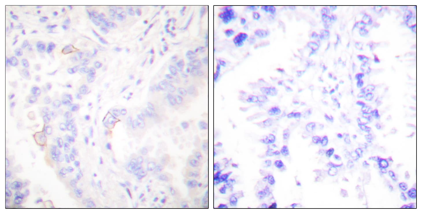 CRK Antibody (aa187-236)