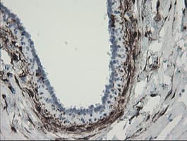 F13A1 / Factor XIIIa Antibody (clone OTI3E3, Carrier-free)