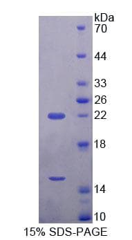 Mouse ECE2 Protein (Recombinant His-T7, N-terminus)