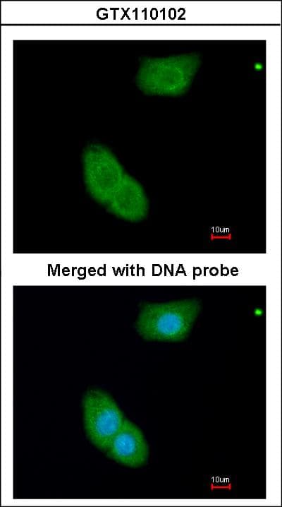 EHBP1 Antibody (aa595-886)
