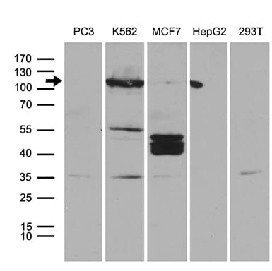 Monoclonal Mouse anti-Human PKN3 Antibody (clone OTI11D8, aa1-275, WB)