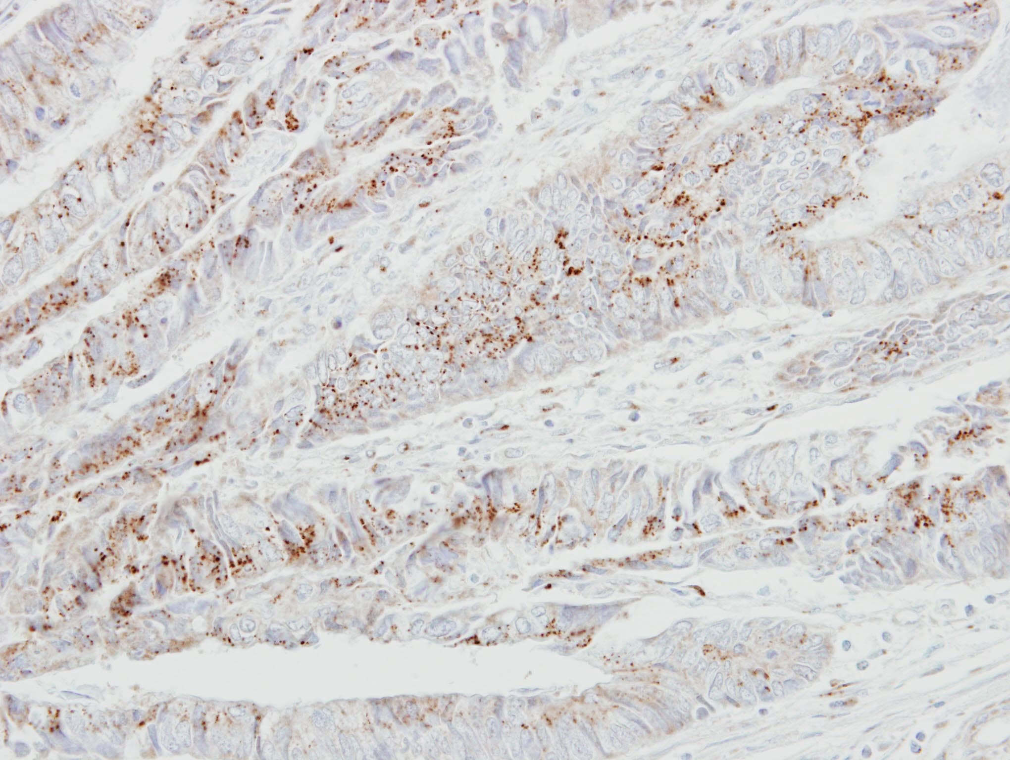 GALNT2 Antibody (aa55-369)