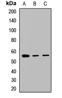 Polyclonal Rabbit anti-Human GABRA3 Antibody (WB)