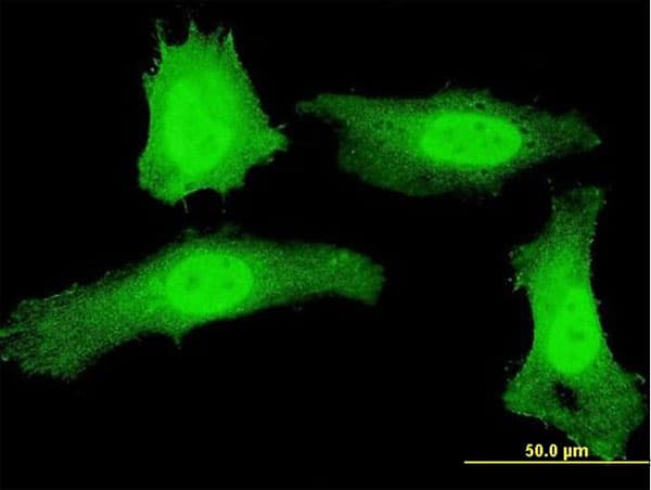 PathPlus™ Monoclonal Mouse anti-Human PLEKHG5 Antibody (clone 5A9, IHC, IF, WB)