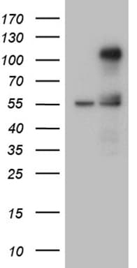 TCF12 / HEB Antibody (clone OTI4B5)