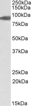 IHC-plus™ Polyclonal Goat anti-Human ACO2 / Aconitase 2 Antibody (aa541-555, IHC, WB)