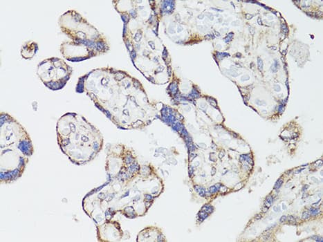 MTOR Antibody