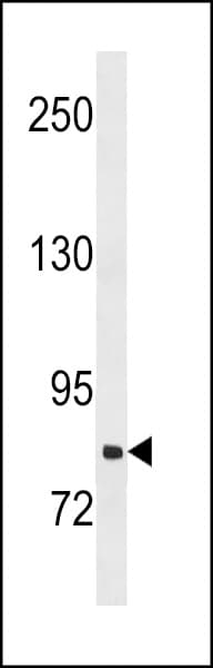 Polyclonal Rabbit anti-Human SLCO1B3 / OATP8 Antibody (aa639-668, WB)