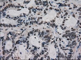 Monoclonal Mouse anti-Human MKI67 / Ki67 Antibody (clone OTI3D11, IHC, WB)