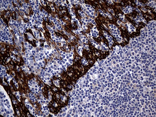 KRT14 / CK14 / Cytokeratin 14 Antibody (aa261-472, clone OTI5F2)