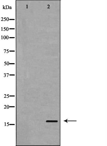 Polyclonal Rabbit anti-Human TTR / Transthyretin Antibody (IHC, WB)