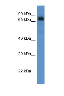 Polyclonal Rabbit anti-Human ACAD9 Antibody (aa552-601, WB)
