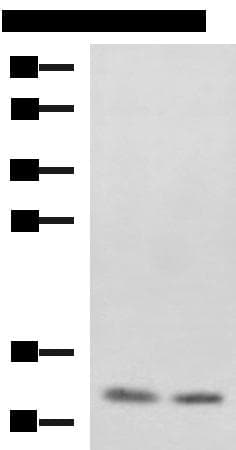 Polyclonal Rabbit anti-Human PHF5A / INI Antibody (IHC, WB)