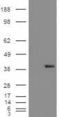 IHC-plus™ Polyclonal Goat anti-Human AKR1A1 Antibody (aa313-325, IHC, WB)
