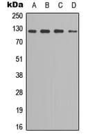 Polyclonal Rabbit anti-Human SREBF1 / SREBP-1 Antibody (phospho-Ser439, IHC, WB)
