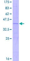 Human PLA2G12B Protein (Recombinant GST, N-terminus)