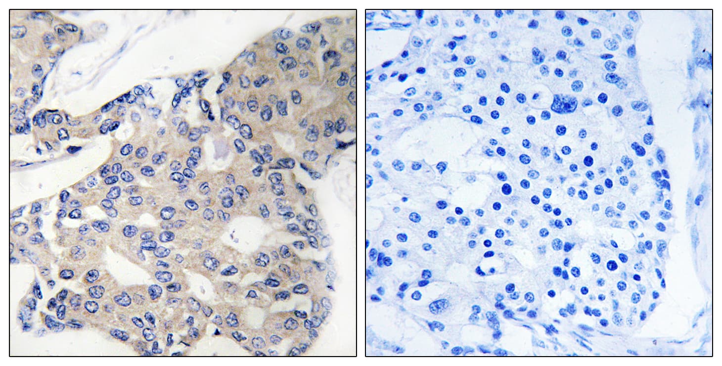 ARA70 / NCOA4 Antibody