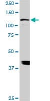 IHC-plus™ ADAMTS17 Antibody (clone 3B7)