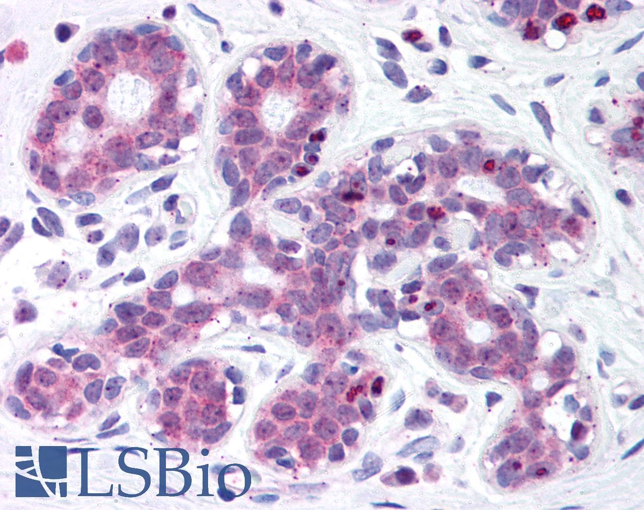 IHC-plus™ ITIH1 Antibody (aa410-592, clone 2B7)