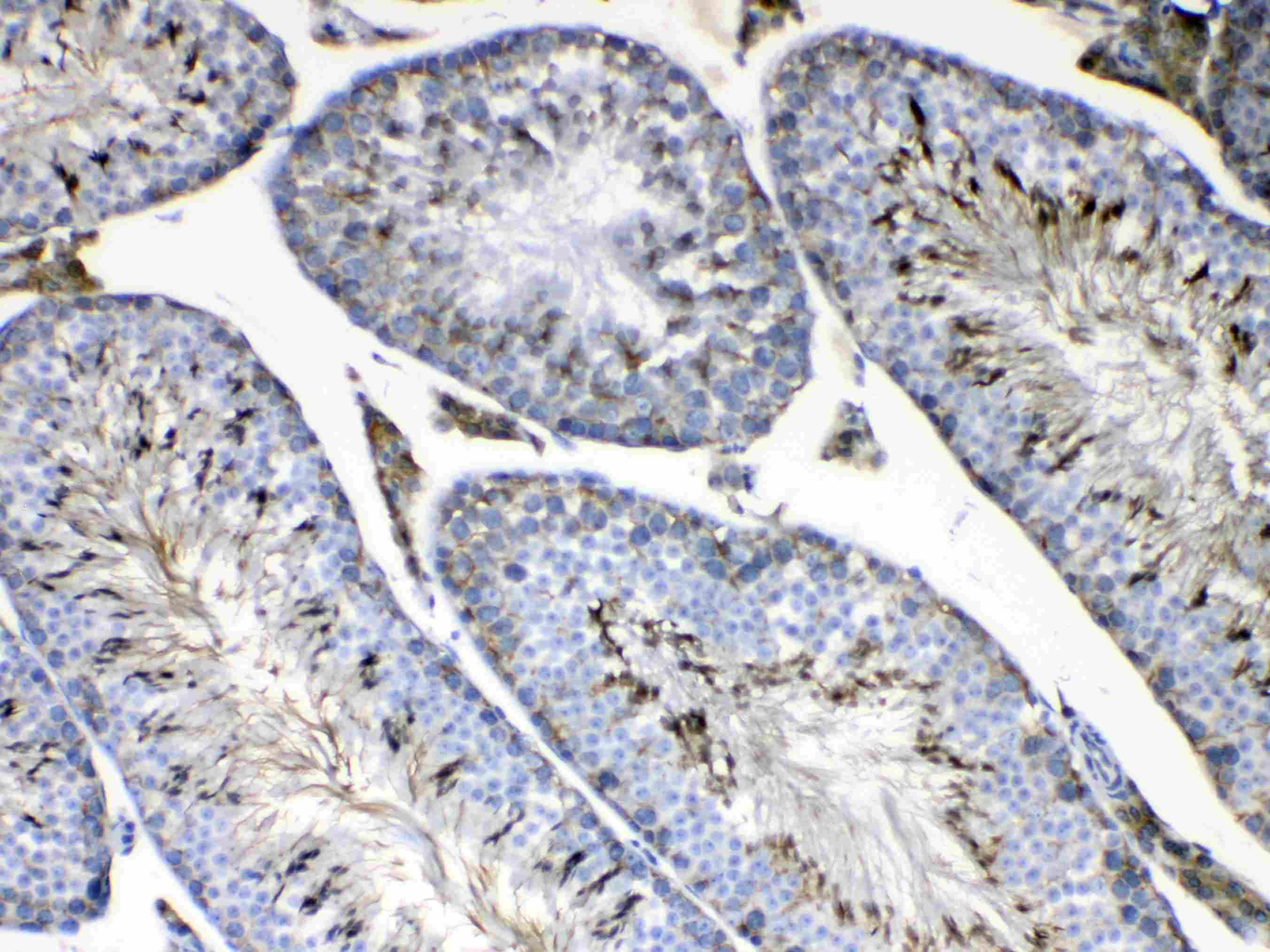 FMN1 Antibody