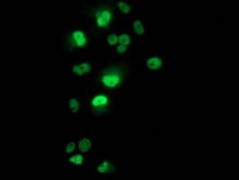 TP53 / p53 Antibody (clone OTI5E2)