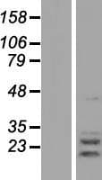 AGPAT2 Protein (Over-Expression Lysate Myc-DDK (Flag))