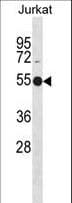AUTL1 / ATG4C Antibody (aa33-62)