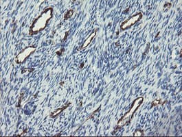 PECAM-1 / CD31 Antibody (clone OTI1D2)