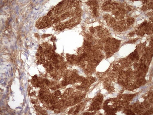Monoclonal Mouse anti-Human HBP17 / FGFBP1 Antibody (clone OTI2B6, aa24-234, IHC, WB)
