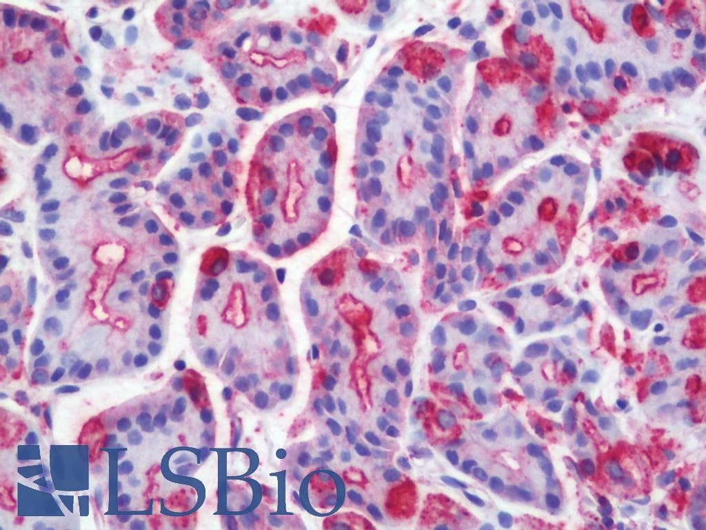 IHC-plus™ WNT10A Antibody (Internal)
