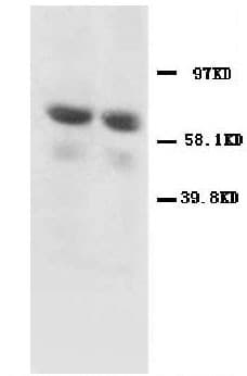 GAD65 Antibody (aa21-37)