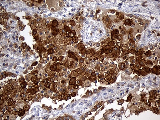 GRB7 Antibody (clone OTI6H2, Carrier-free)