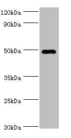 Polyclonal Rabbit anti-Human HYAL1 Antibody (aa136-435, IHC, WB)